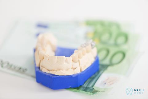 Zuby na splátky v BRILL DENT